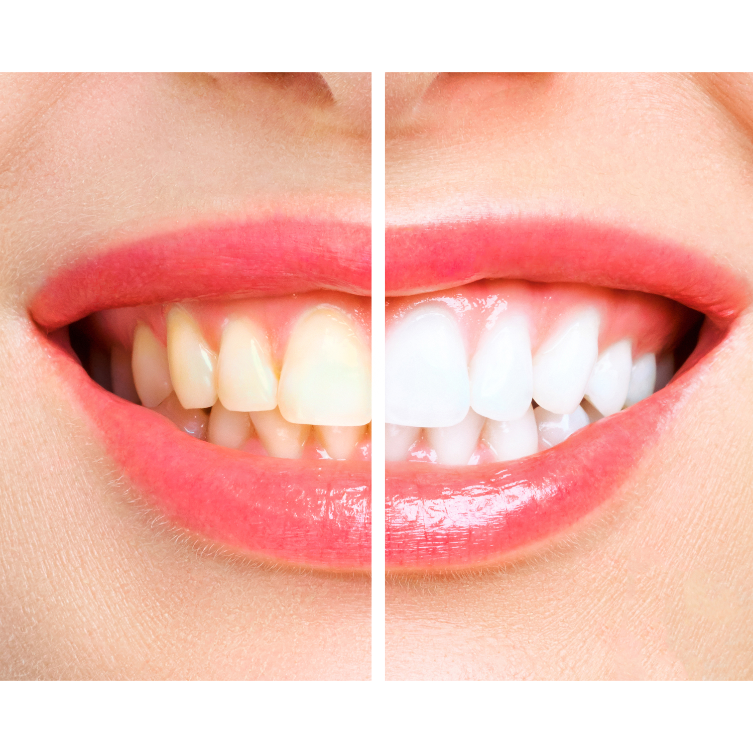 4 Opzetborstels voor AG350